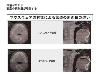 「酸素の吸入量」の向上