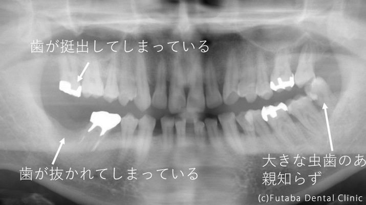 歯の構造