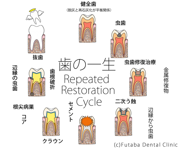 歯の一生new