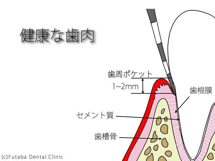 健康な歯肉new.004