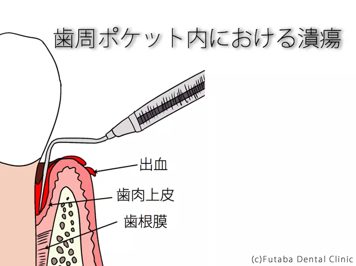 手の平　うんち.001