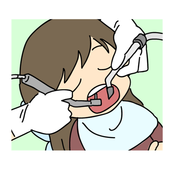 インプラント