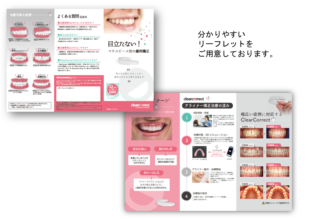 目立たない矯正治療