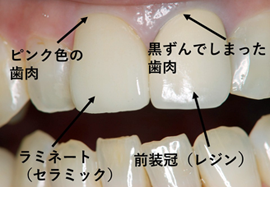 S様症例写真