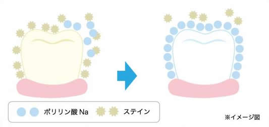 ホワイトニングしながら歯をコーティング！