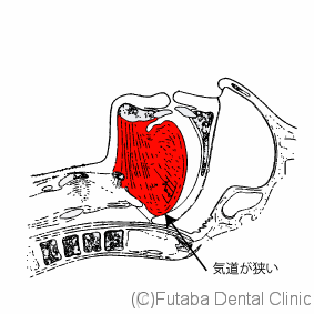 気道close