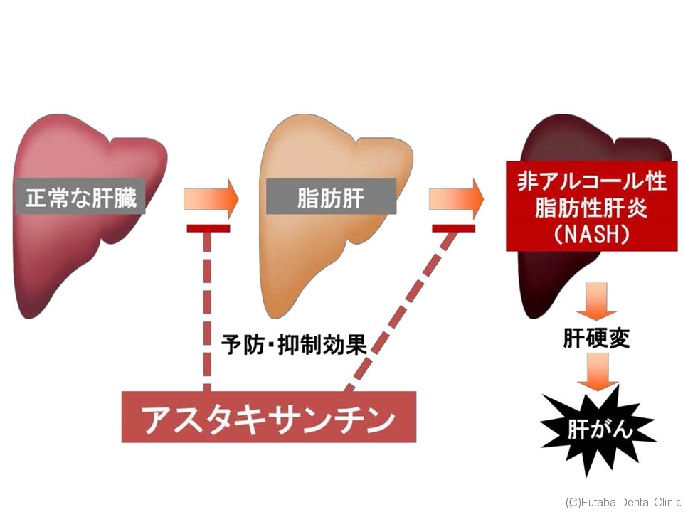 アスタキサンチン さいたま市北区 宮原町 日進町 歯医者 雙葉デンタルクリニック アスタキサンチン さいたま市北区 宮原町 日進町 歯医者 雙葉デンタルクリニック